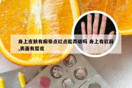 身上皮肤有癣带点红点能弄破吗 身上有红藓,表面有层皮