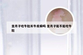 坐月子吃牛肚长牛皮癣吗 坐月子能不能吃牛肚