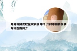 开封朝鲜皮肤医院到底咋样 开封市朝鲜皮肤专科医院简介