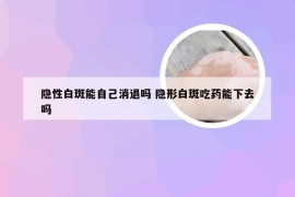 隐性白斑能自己消退吗 隐形白斑吃药能下去吗