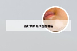 最好的白癜风医院电话