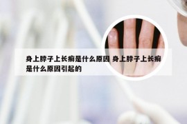 身上脖子上长癣是什么原因 身上脖子上长癣是什么原因引起的
