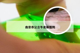 南京市公立牛皮癣医院