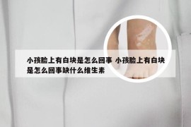 小孩脸上有白块是怎么回事 小孩脸上有白块是怎么回事缺什么维生素