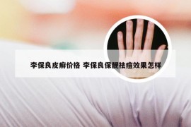 李保良皮癣价格 李保良保靓祛痘效果怎样