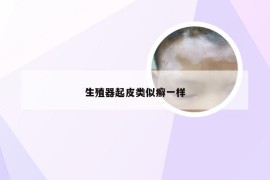 生殖器起皮类似癣一样