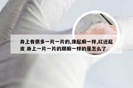 身上有很多一片一片的,像起癣一样,红还起皮 身上一片一片的跟癣一样的是怎么了