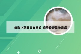 癣敌中药乳膏有用吗 癣敌软膏是激素吗