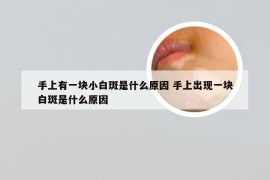 手上有一块小白斑是什么原因 手上出现一块白斑是什么原因