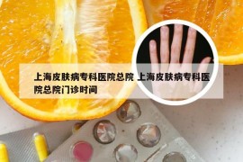 上海皮肤病专科医院总院 上海皮肤病专科医院总院门诊时间