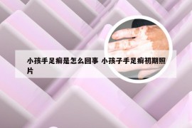 小孩手足癣是怎么回事 小孩子手足癣初期照片