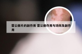 雷公藤片的副作用 雷公藤作用与功效及副作用