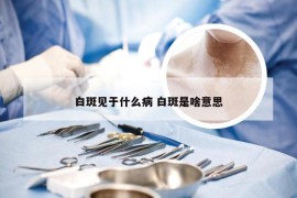 白斑见于什么病 白斑是啥意思