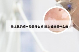 脸上起的癣一般是什么癣 脸上长癣是什么癣