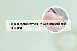 银屑病患者可以吃兰州拉面吗 银屑病能吃方便面调料
