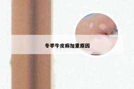 冬季牛皮癣加重原因