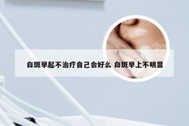 白斑早起不治疗自己会好么 白斑早上不明显