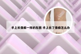 手上长像癣一样的东西 手上长了像癣怎么办