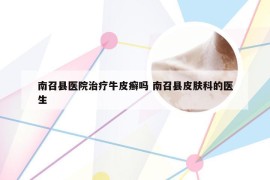 南召县医院治疗牛皮癣吗 南召县皮肤科的医生