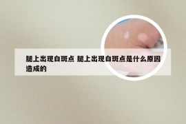 腿上出现白斑点 腿上出现白斑点是什么原因造成的