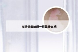 皮肤像癞蛤蟆一样是什么病