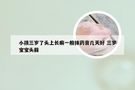 小孩三岁了头上长癣一般抹药膏几天好 三岁宝宝头藓