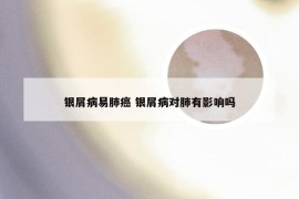 银屑病易肺癌 银屑病对肺有影响吗
