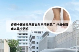 疗癣卡西甫散陕西省科学院制药厂 疗癣卡西甫丸是中药吗