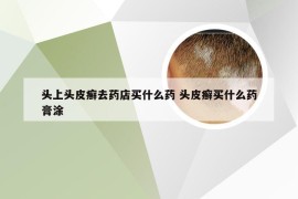 头上头皮癣去药店买什么药 头皮癣买什么药膏涂
