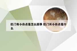 肛门有小白点是怎么回事 肛门长小白点是什么