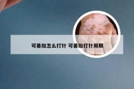 可善挺怎么打针 可善挺打针周期