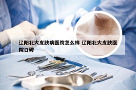 辽阳北大皮肤病医院怎么样 辽阳北大皮肤医院口碑