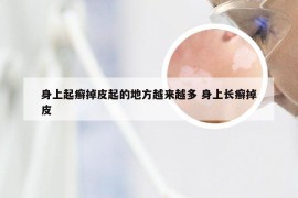 身上起癣掉皮起的地方越来越多 身上长癣掉皮
