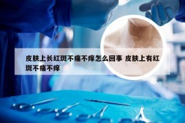 皮肤上长红斑不痛不痒怎么回事 皮肤上有红斑不痛不痒