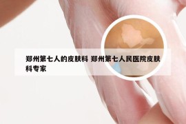 郑州第七人的皮肤科 郑州第七人民医院皮肤科专家