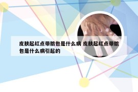 皮肤起红点带脓包是什么病 皮肤起红点带脓包是什么病引起的