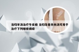 当归羊汤治疗牛皮癣 当归生姜羊肉汤可用于治疗下列哪些病症