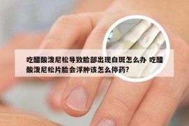 吃醋酸泼尼松导致脸部出现白斑怎么办 吃醋酸泼尼松片脸会浮肿该怎么停药?