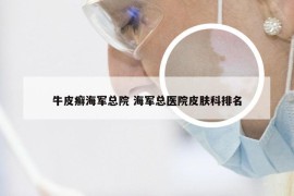 牛皮癣海军总院 海军总医院皮肤科排名