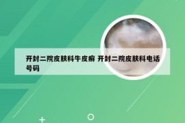 开封二院皮肤科牛皮癣 开封二院皮肤科电话号码