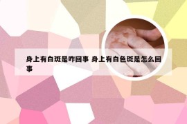 身上有白斑是咋回事 身上有白色斑是怎么回事