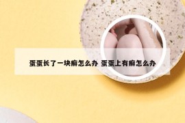 蛋蛋长了一块癣怎么办 蛋蛋上有癣怎么办