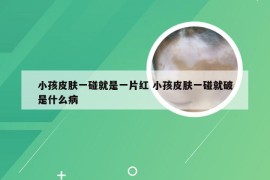 小孩皮肤一碰就是一片红 小孩皮肤一碰就破是什么病