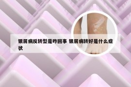 银屑病反转型是咋回事 银屑病转好是什么症状