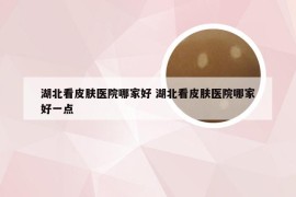 湖北看皮肤医院哪家好 湖北看皮肤医院哪家好一点