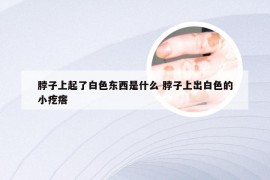 脖子上起了白色东西是什么 脖子上出白色的小疙瘩