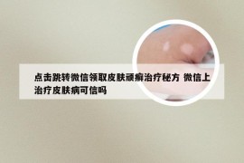 点击跳转微信领取皮肤顽癣治疗秘方 微信上治疗皮肤病可信吗