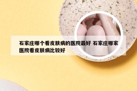 石家庄哪个看皮肤病的医院最好 石家庄哪家医院看皮肤病比较好