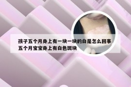 孩子五个月身上有一块一块的白是怎么回事 五个月宝宝身上有白色斑块