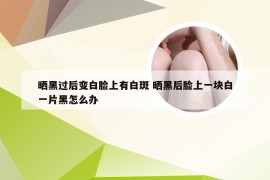 晒黑过后变白脸上有白斑 晒黑后脸上一块白一片黑怎么办